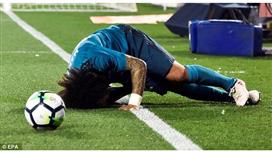 الصحافة المدريدية تحدد مدى خطورة إصابة مارسيلو
